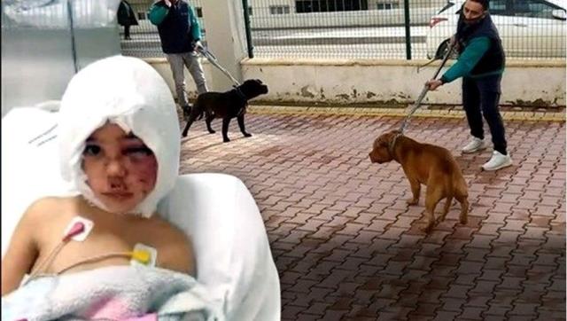 Pitbull Saldırısına Uğrayan Asiye'ye Erdoğan Sahip Çıktı